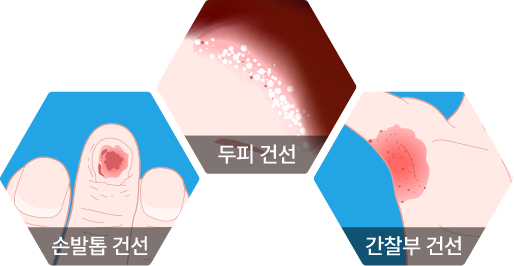 section5_hexagon2